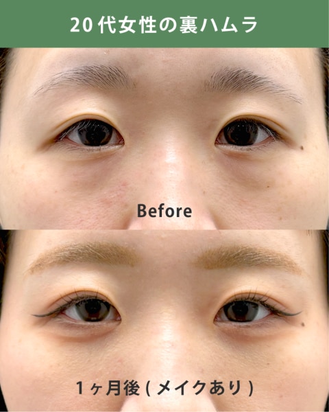 20代女性：ノーマルカメラで映える目元に