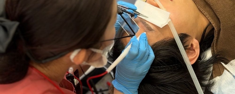 経験豊富な看護師による安心の施術