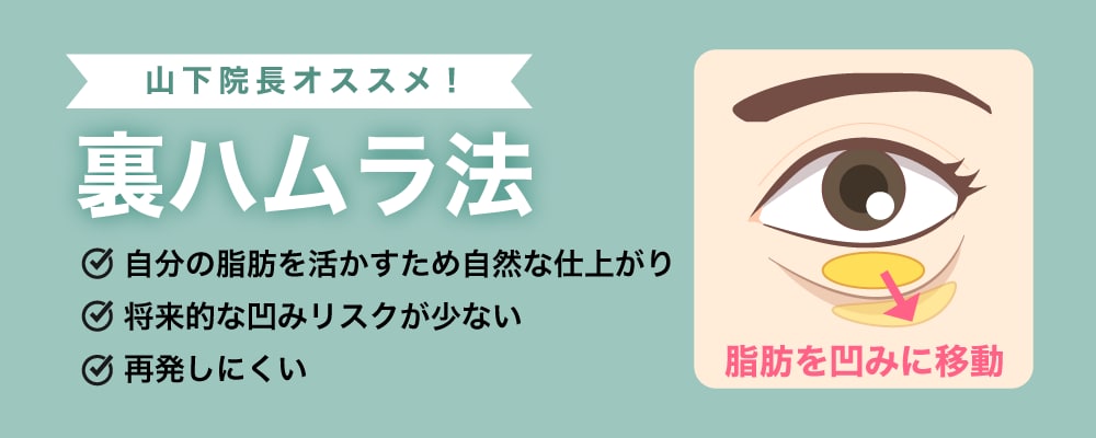 【院長おすすめ】裏ハムラ法