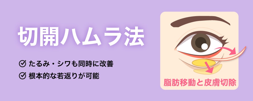 切開ハムラ法