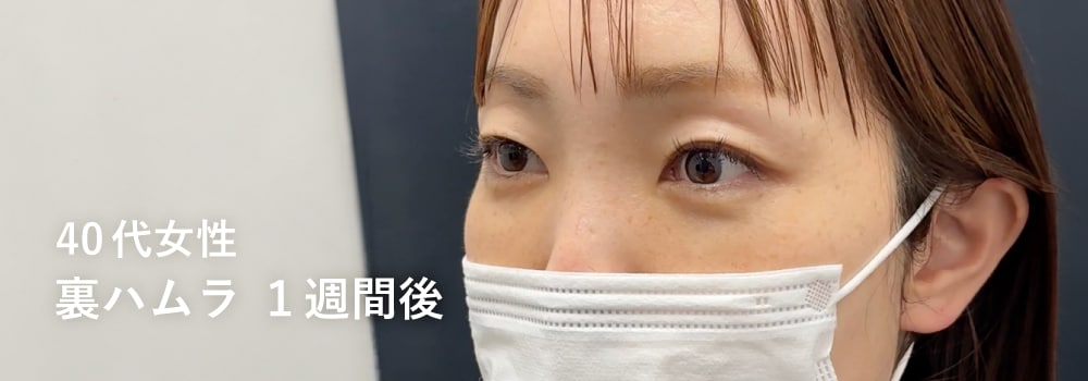 JSAS専門医が実現する「解剖学的ダウンタイム制御」