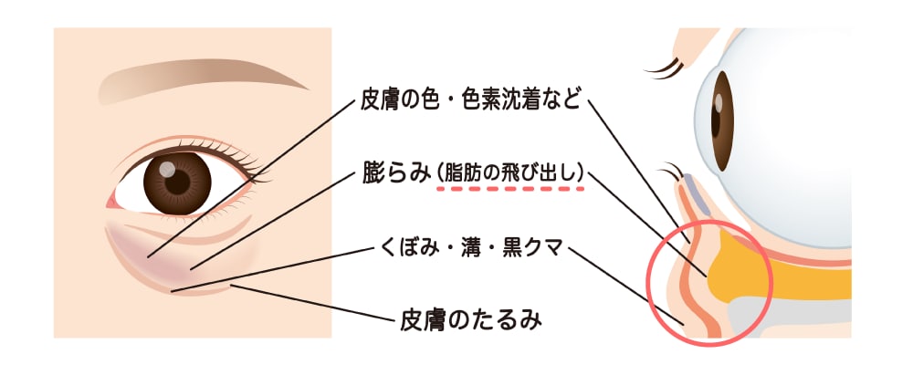 老け見えの原因