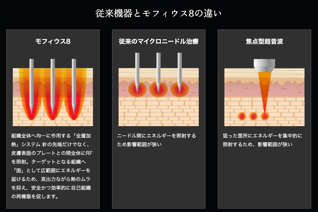 モフィウス8の特徴
