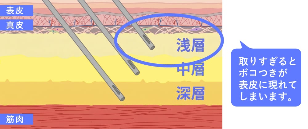あえて「浅い層」を吸いすぎない、という選択