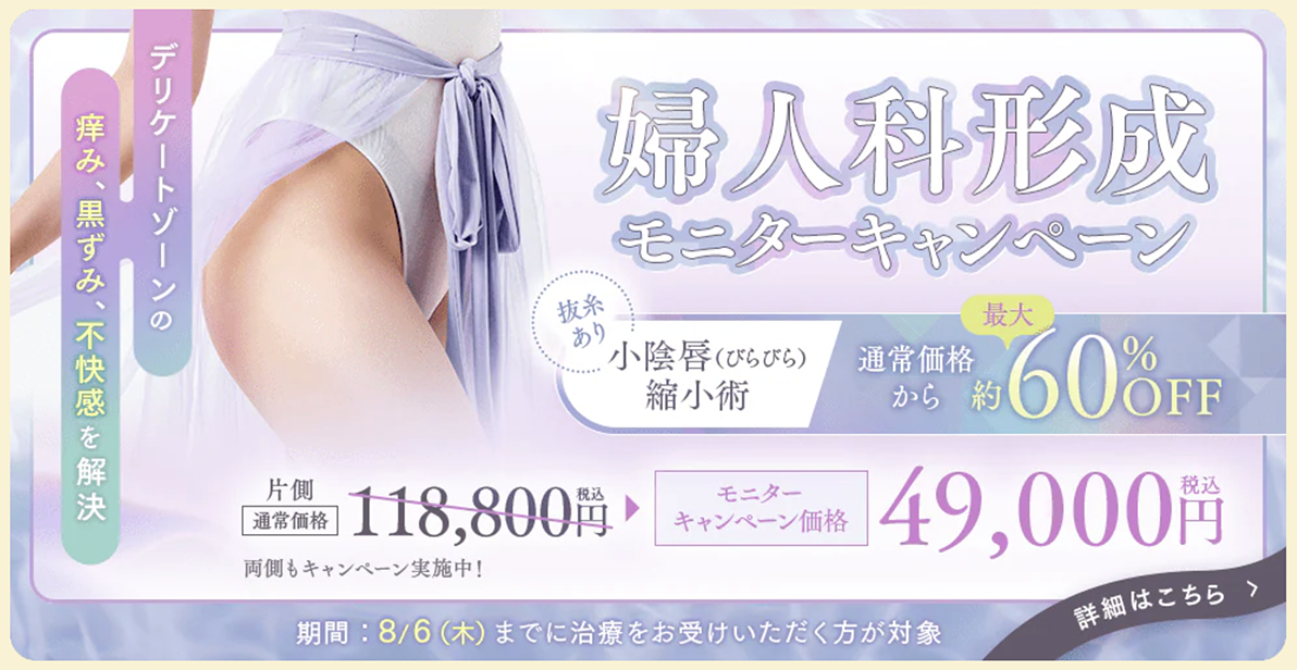 婦人科形成モニターキャンペーン
