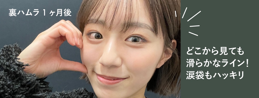 「脂肪を取って終わり」にしない骨格レベルの目元デザイン