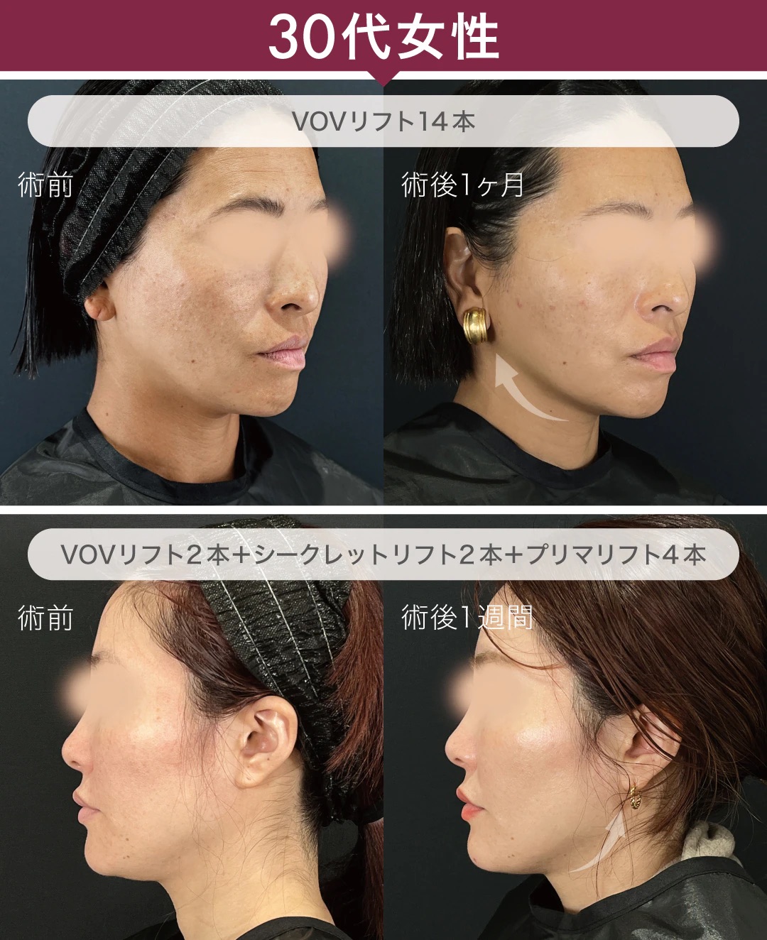 30代症例