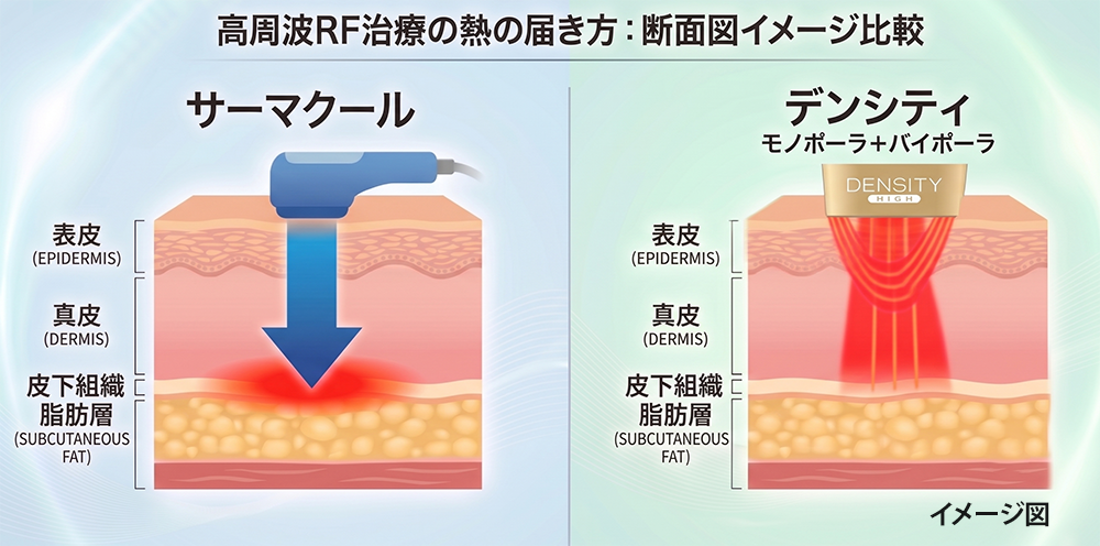 「サーマクール」と「デンシティ」の違い