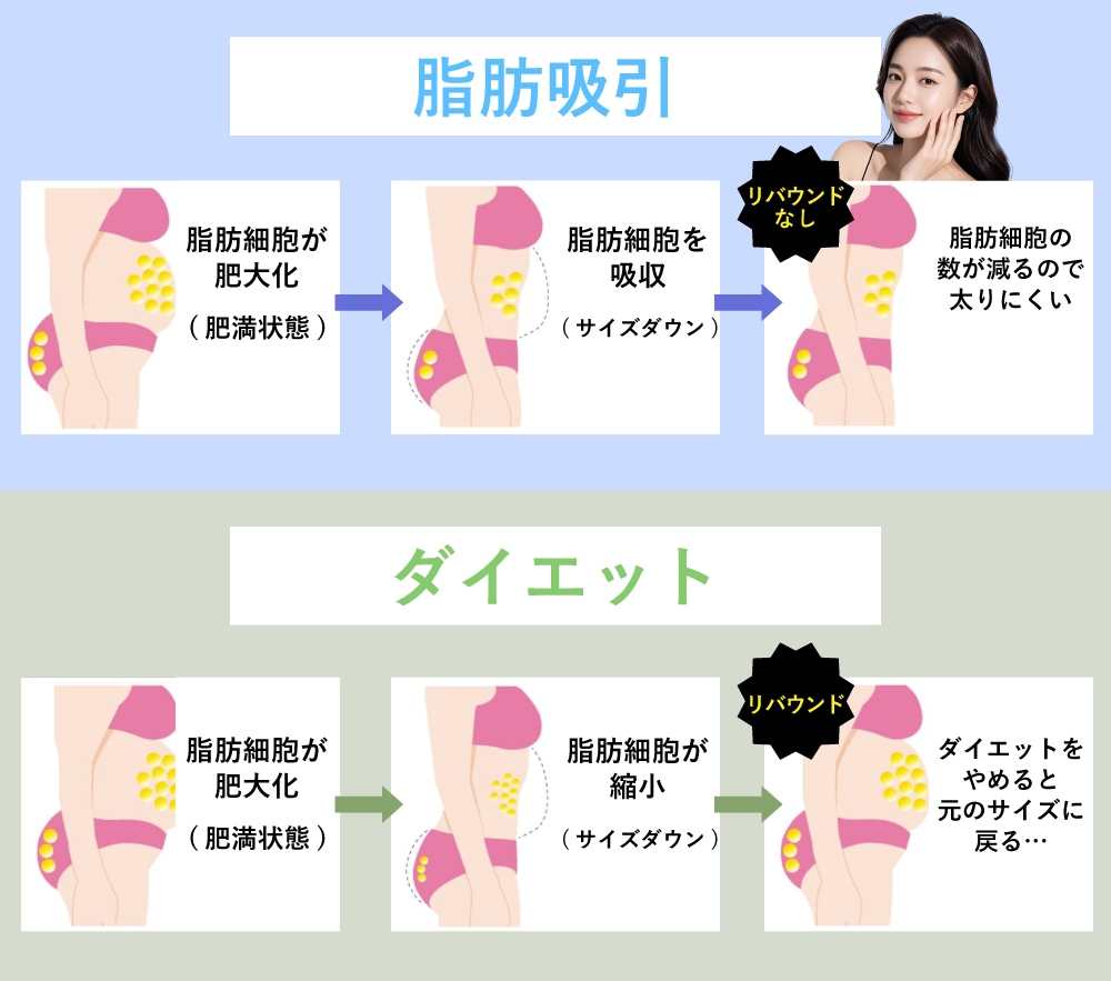 脂肪吸引は脂肪細胞を減らす