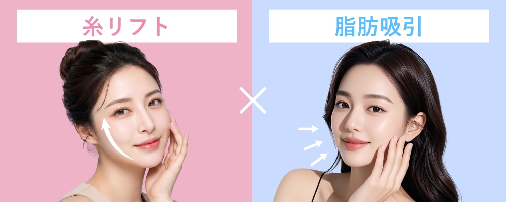 糸リフト×脂肪吸引が人気の理由