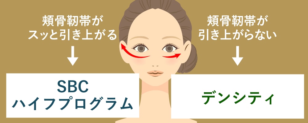 選び方の基準は「お顔の靭帯（SMAS）」の引き上がり方