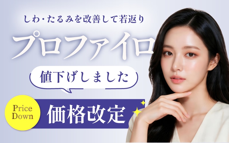 プロファイロ価格改定