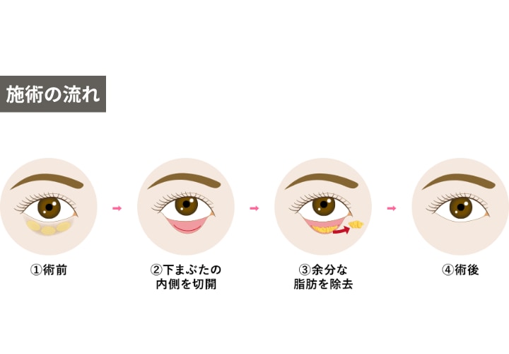 実年齢より老けて見られがち？