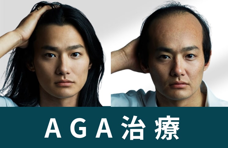 AGA治療