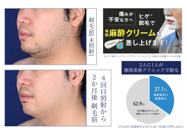 毎日髭を剃るのが面倒なあなたに！