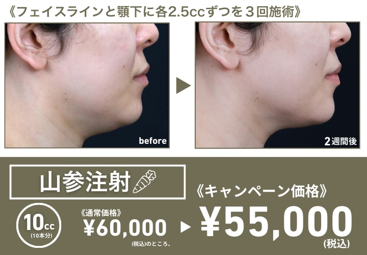 高麗人参の力で脂肪燃焼！