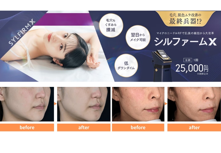 シルファームX
