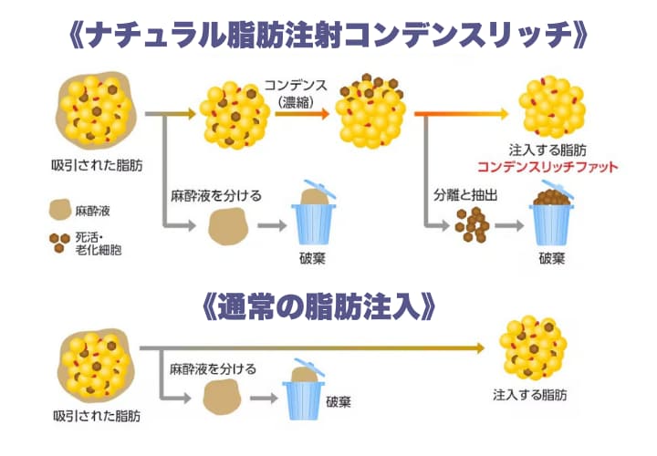 不純物除去することで、定着率がUP⤴︎