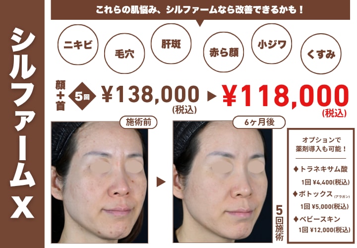 肌状態に合わせた完全カスタム式！