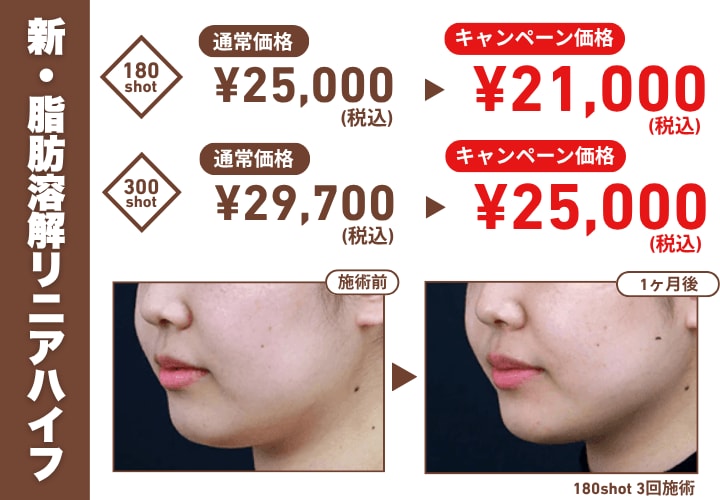 切らずにスッキリフェイスラインに！