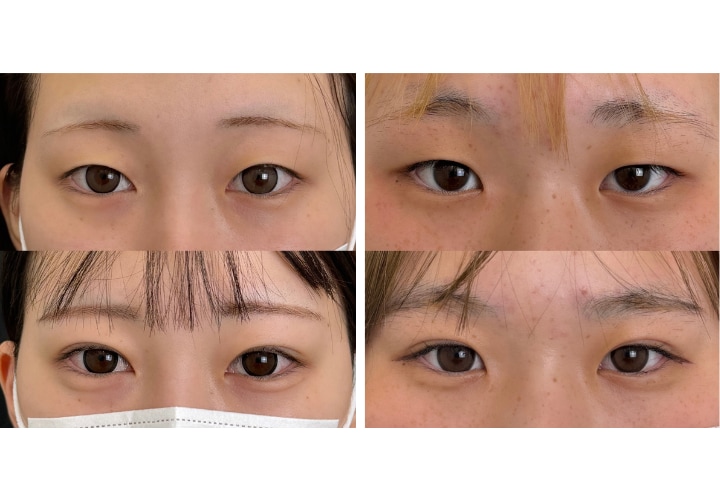 クイックコスメティークダブルNeo