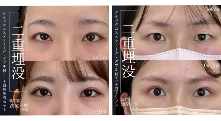 02｜「バレない自然さ」を追求する高いデザイン性と確かな技術力<br />
