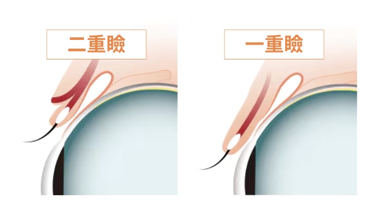 一重と二重、何が違うの？<br />
