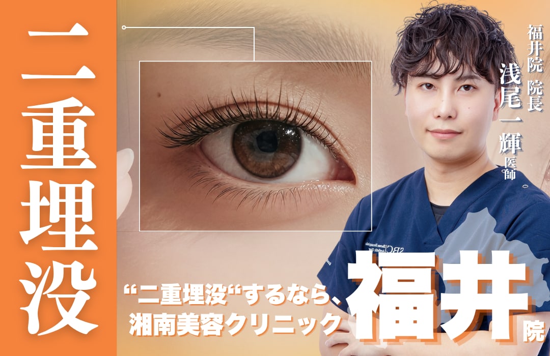 福井で”二重整形”するなら浅尾院長のいるSBC福井院へ｜湘南美容クリニック