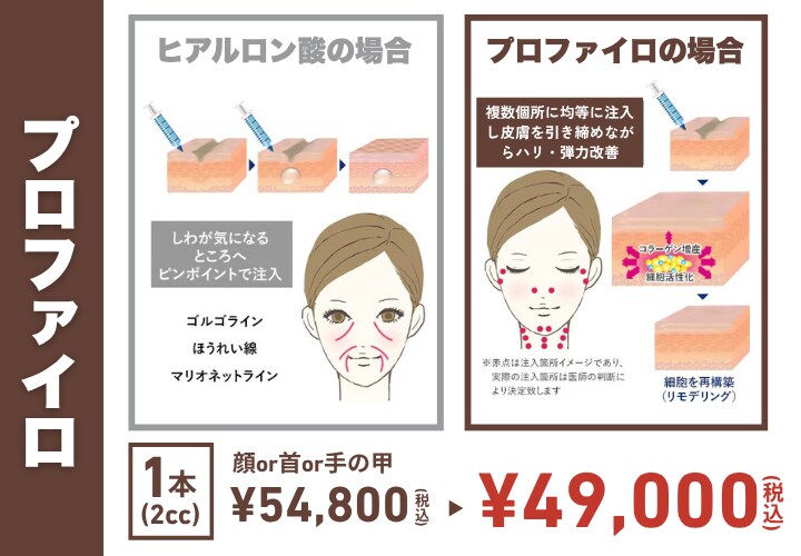 プロファイロ<br />
