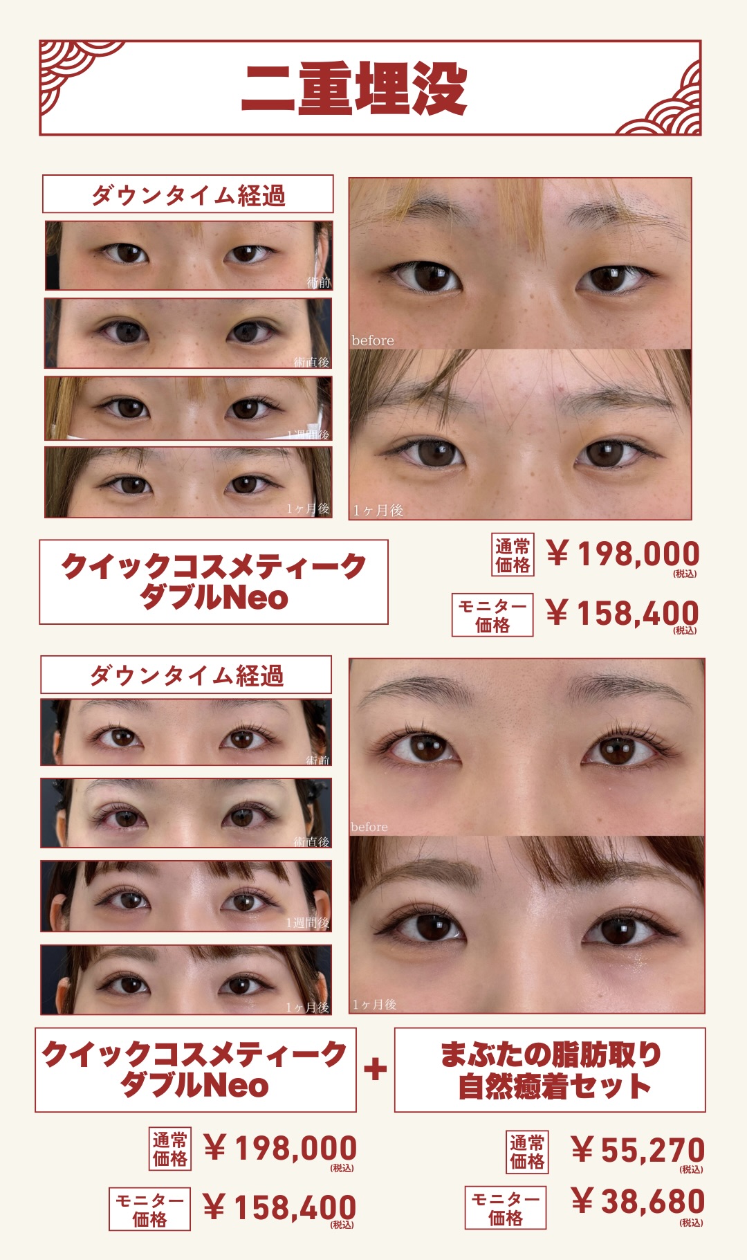 ❄️二重埋没❄️