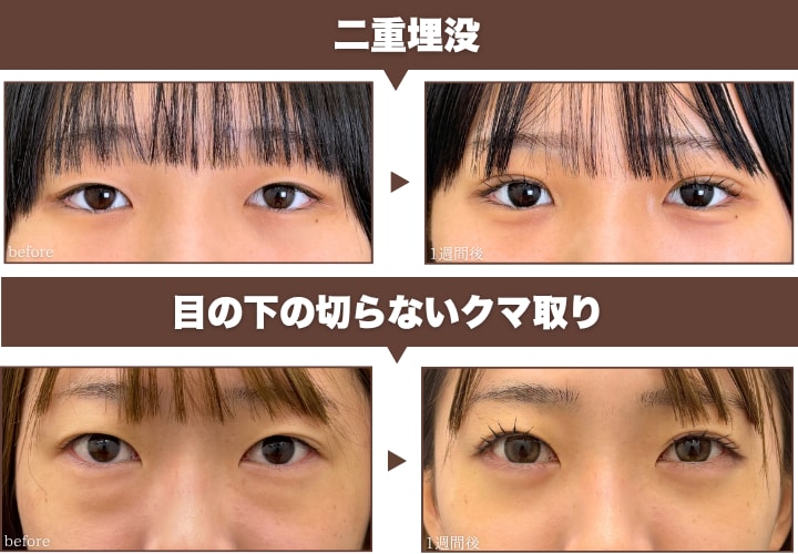 他にもこんな使い方が！🉐✨