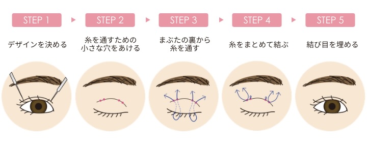 医師と相談し、お客様の理想に近づけるようにデザインしていきます👀✨