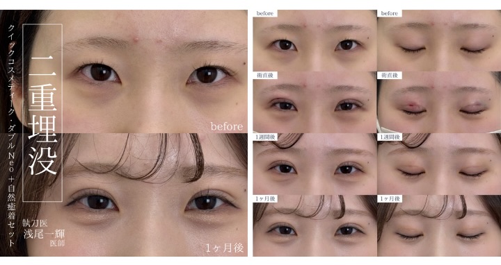 まぶたが重い方、厚い方におすすめ！✨