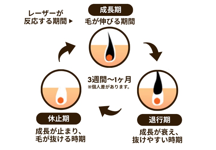 医療脱毛の仕組みは？