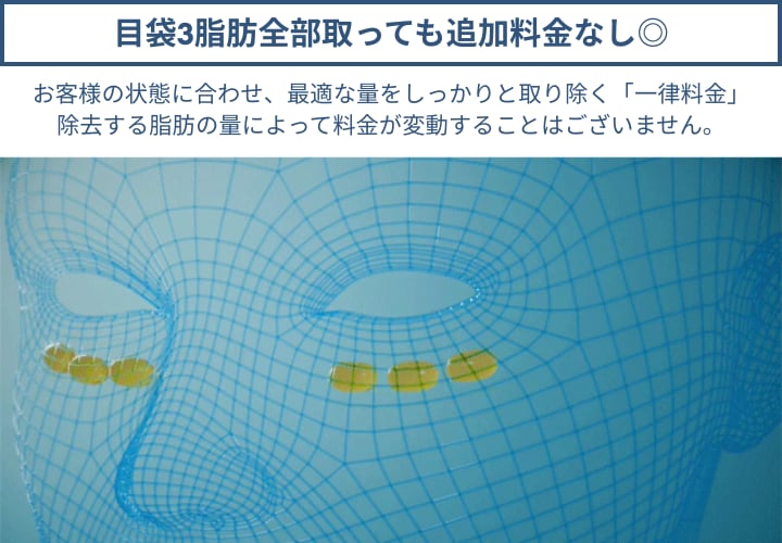 ③ 湘南美容クリニックなら追加料金なし<br />

