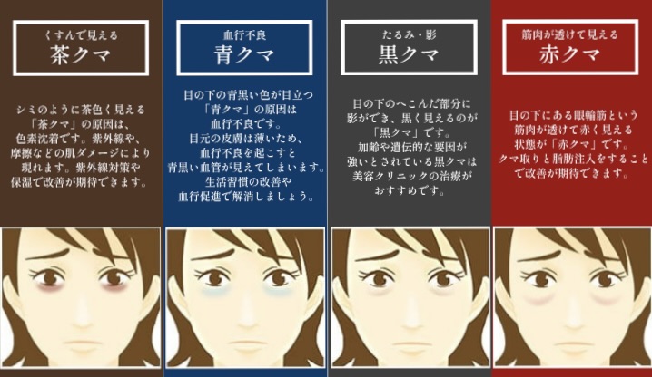 ① 見た目年齢を左右する「4大クマ」の見分け方<br />

