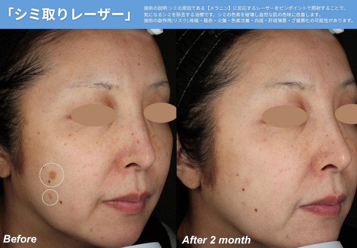 「シミ」「シワ」「たるみ」などお悩みに合わせてアプローチ。<br />
年齢とともに増えていく肌悩みに美容医療という選択。