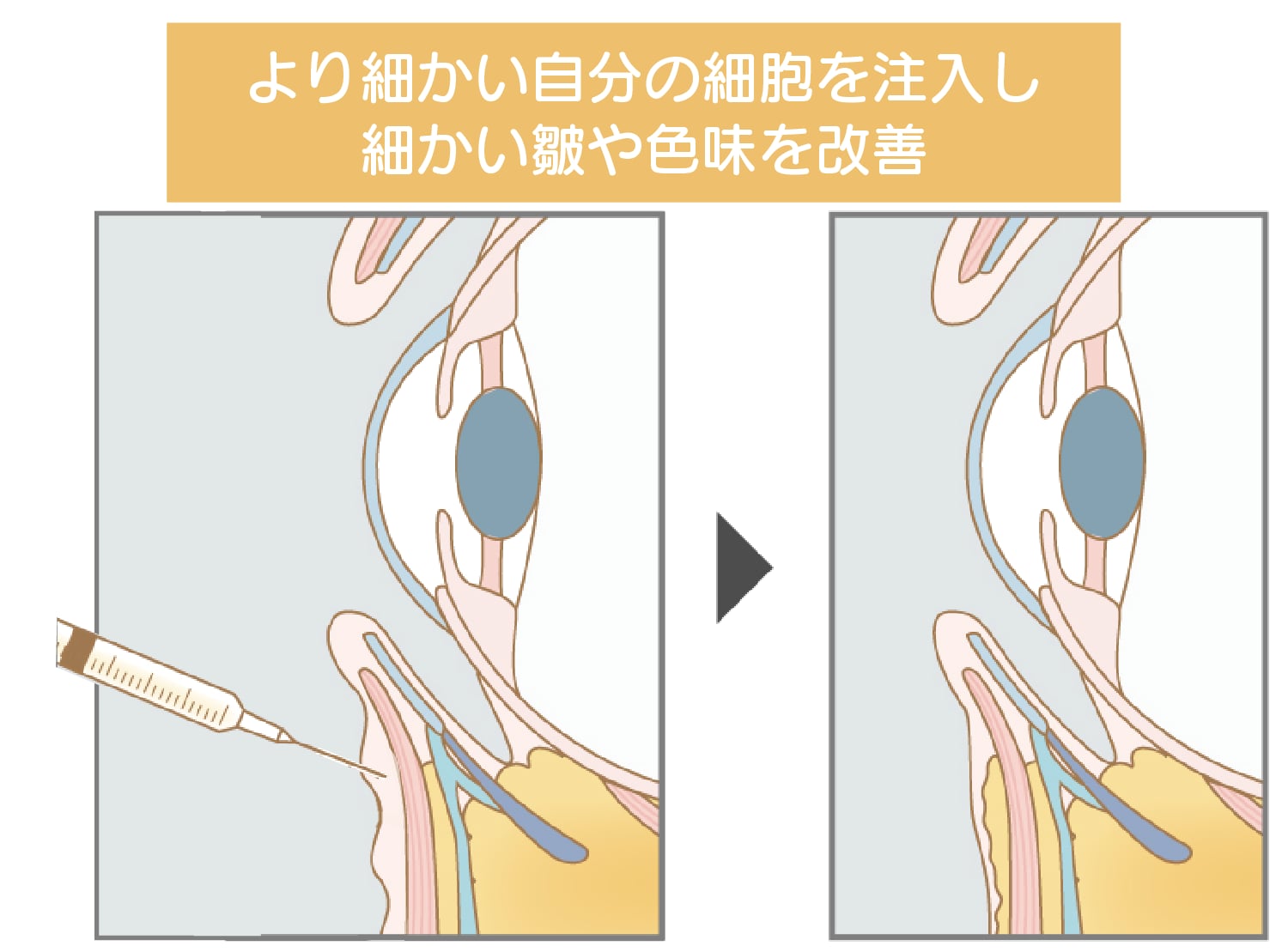 ナノリッチ