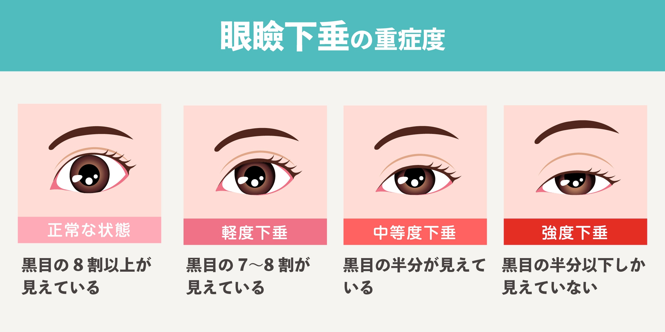 眼瞼下垂をそのままにしておくとダメなの?