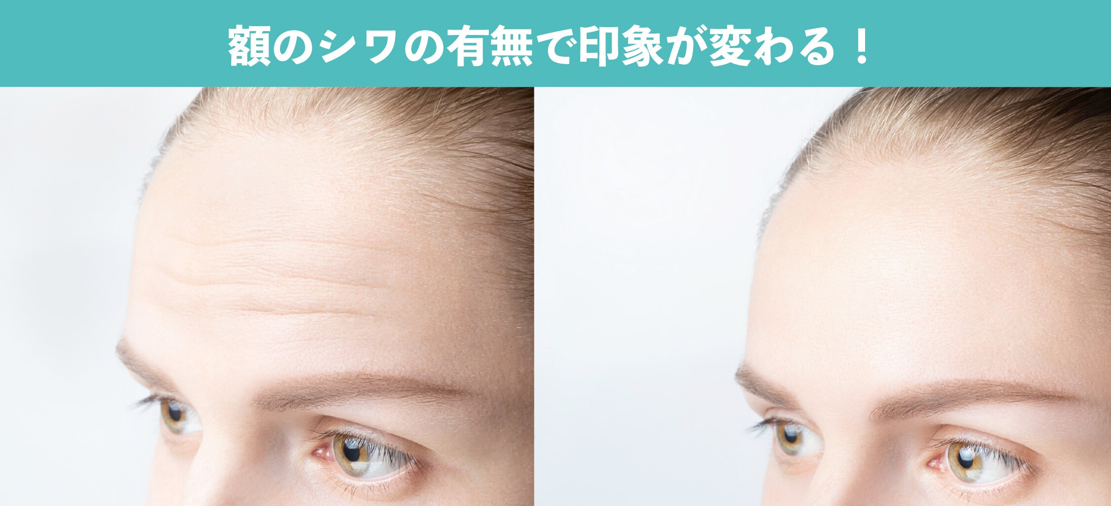 額のシワが増える