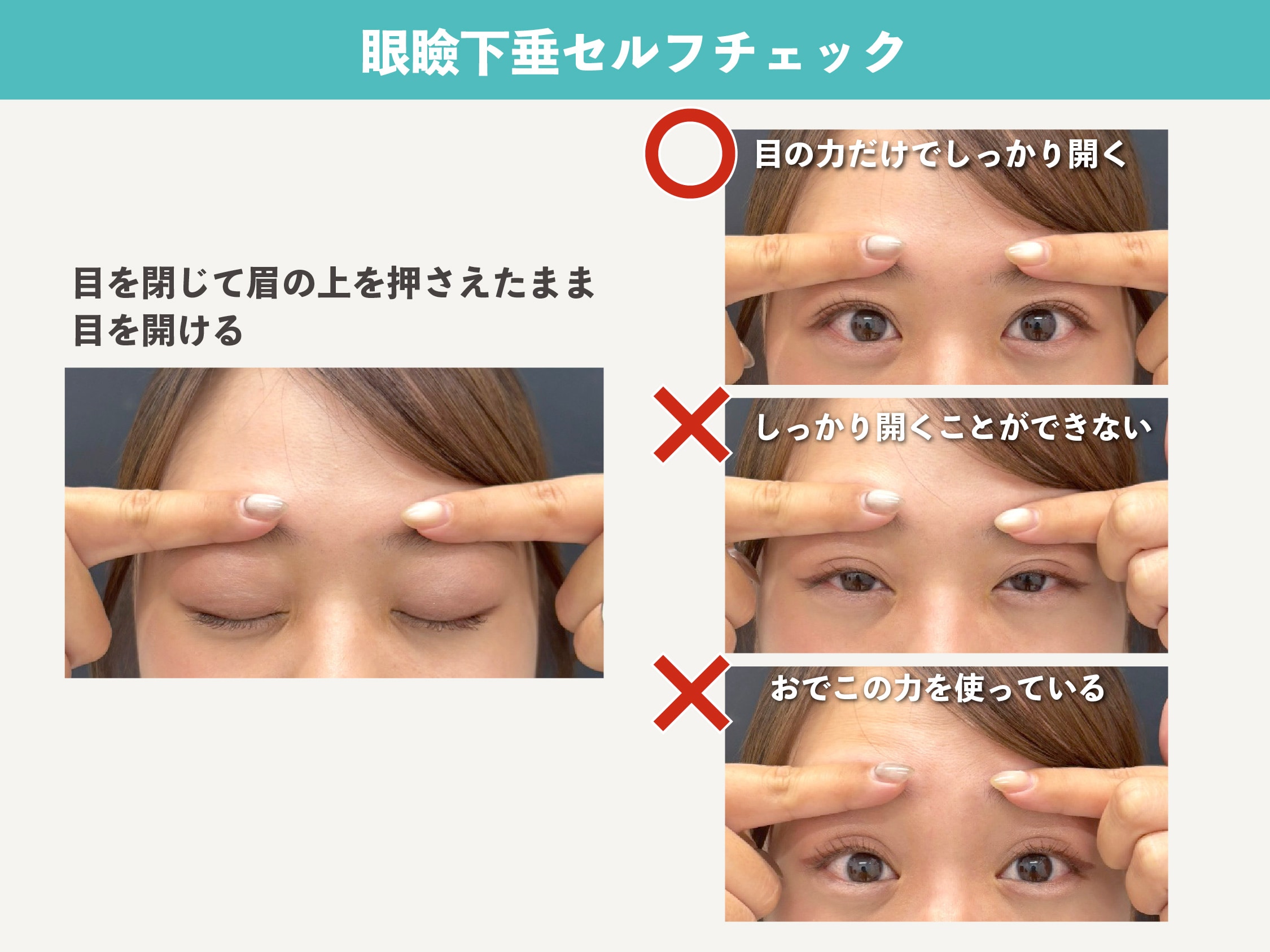 私、眼瞼下垂かも?と思ったら即やってみて!