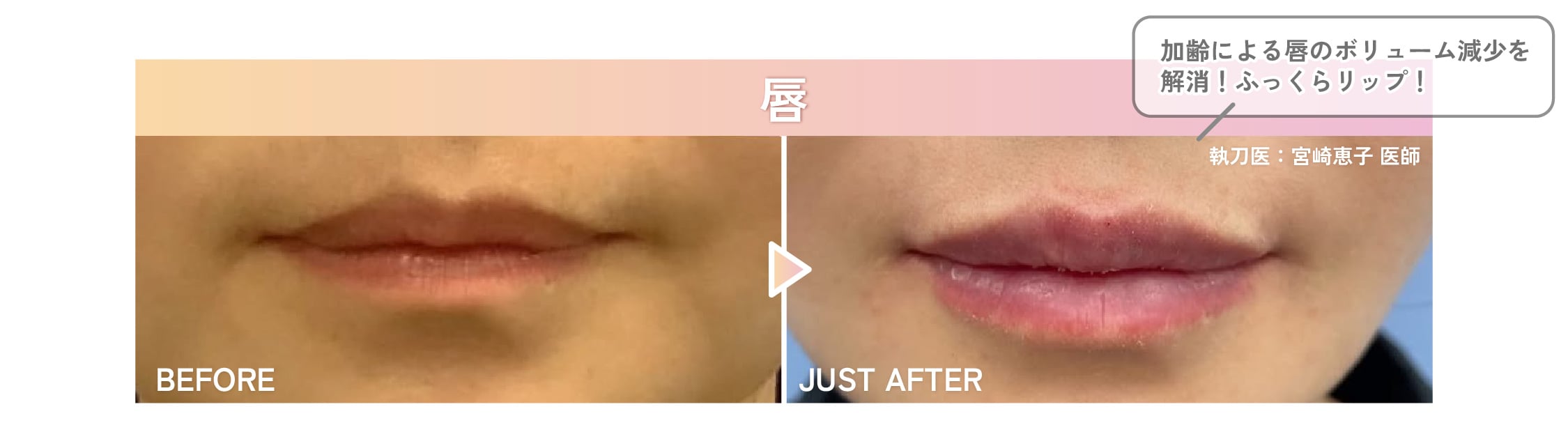 唇