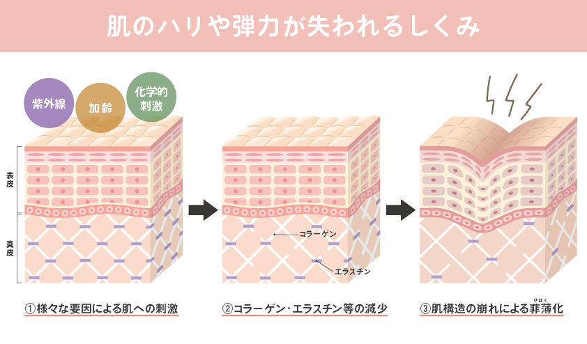 肌悩みの原因