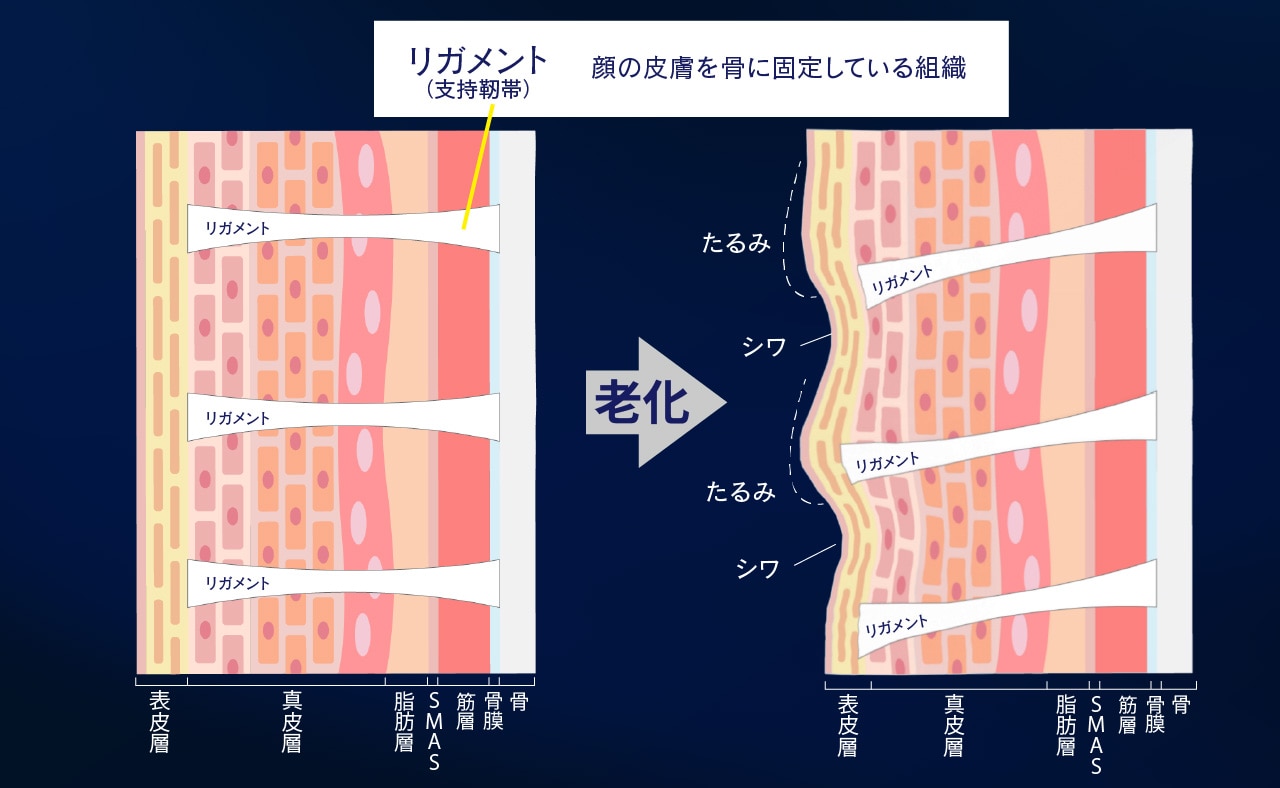 その「たるみ」の原因、知っていますか？