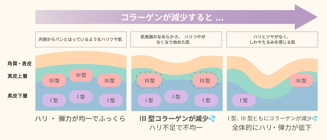 コラーゲンが減少するとどうなるの？