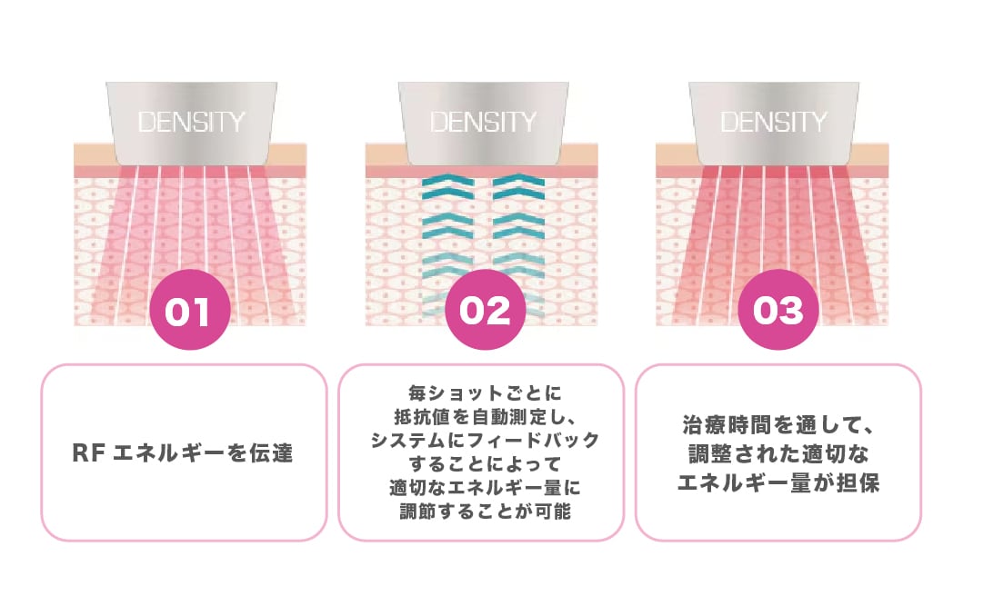 肌の抵抗値を測定できる「リアルタイムインピーダンスチェック機能」が搭載