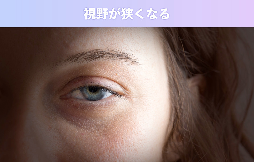 視野が狭くなる