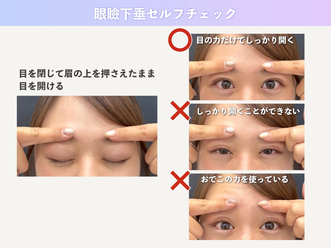 私、眼瞼下垂かも？と思ったら即やってみて！