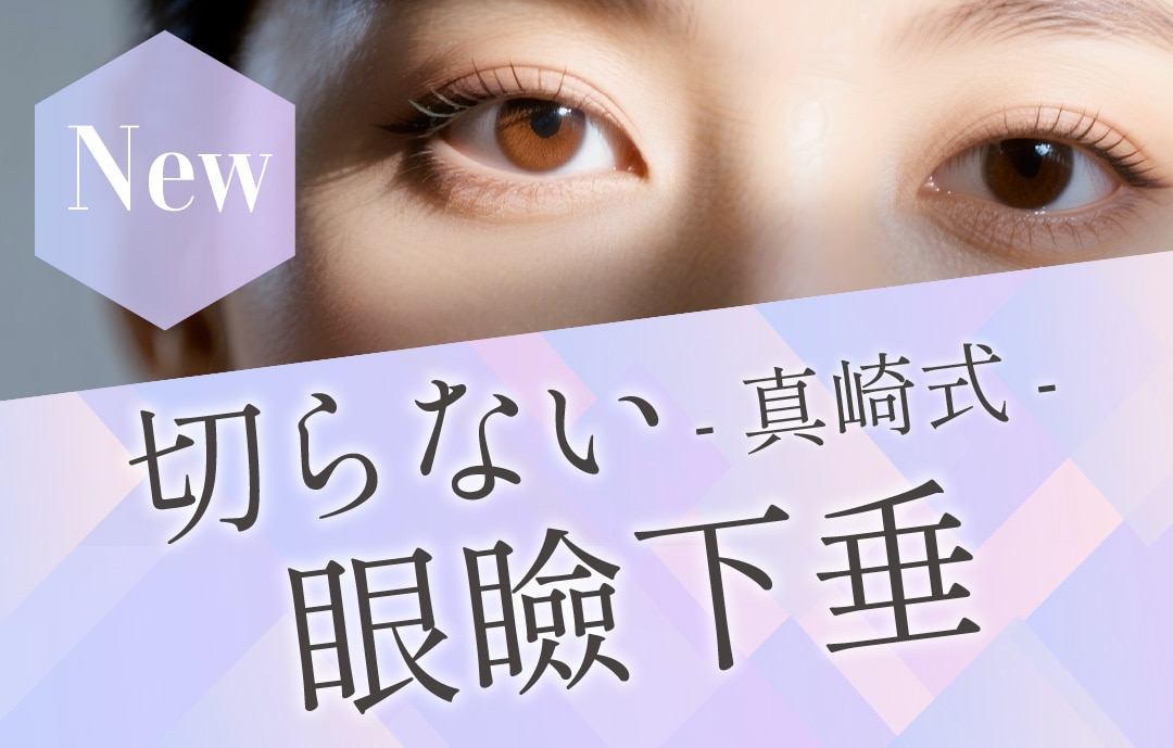 【眼瞼下垂】【福岡・天神・博多】福岡で切らずに目の開きをよくするなら湘南美容クリニック福岡院で！