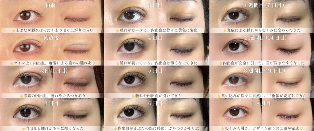 ダウンタイムはどのくらいですか？